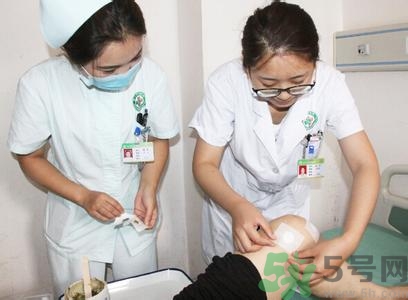 三伏貼可以自己貼嗎？三伏貼貼要找穴位嗎？