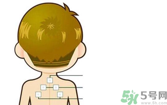 三伏貼可以去濕氣嗎？三伏貼去濕氣貼哪里？