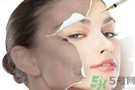 美白針效果怎么樣？美白針有副作用嗎？