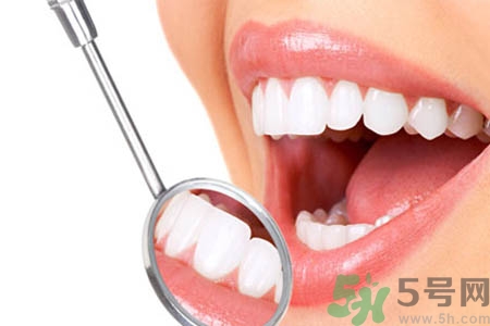 哪些人不能洗牙？洗牙需要注意什么？