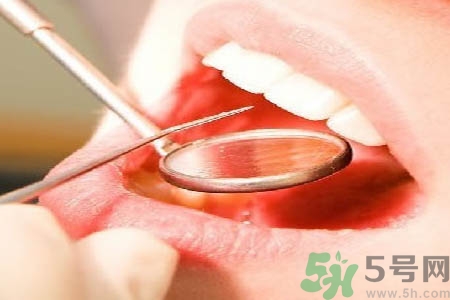 冷光美白牙齒是什么？冷光美白牙齒的好處有哪些？