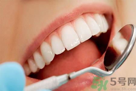 冷光美白牙齒的價格是多少？做冷光美白牙齒需要多少錢？