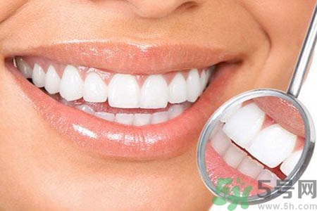 冷光美白牙齒的價(jià)格是多少？做冷光美白牙齒需要多少錢(qián)？