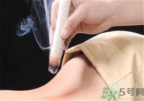 蕁麻疹可以艾灸嗎？蕁麻疹艾灸哪個穴位？