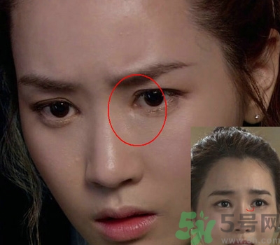 開眼角多少錢？開眼角有什么危害？