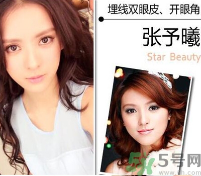 開(kāi)眼角眼睛會(huì)變大嗎？開(kāi)眼角眼睛能大多少？