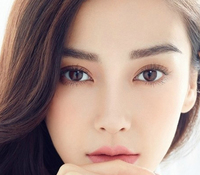 開眼角會留疤嗎？開眼角增生怎么辦？