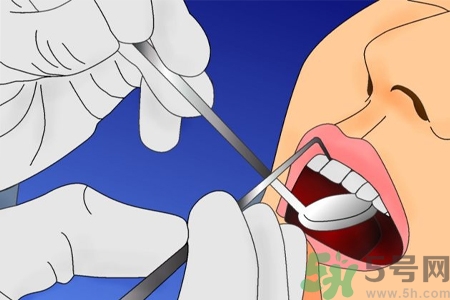 拔牙后需要注意什么？拔牙前需要注意什么？