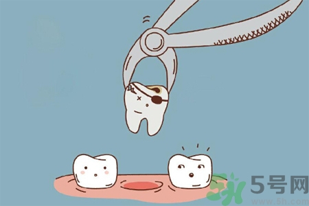 拔牙后需要注意什么？拔牙前需要注意什么？