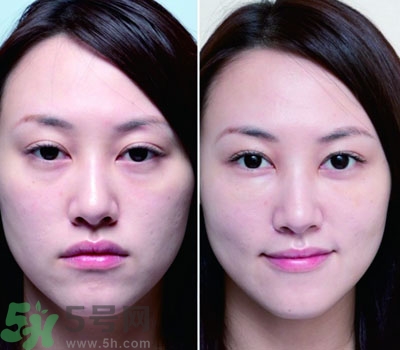 臥蠶是什么？臥蠶是眼袋嗎？