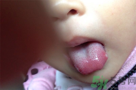 舌頭長泡怎么辦？舌頭長泡的原因？