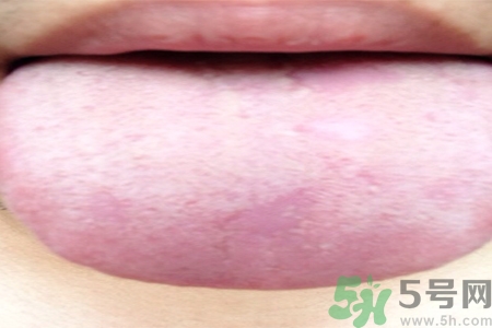 舌頭發(fā)白是什么原因？舌苔發(fā)白是怎么辦？