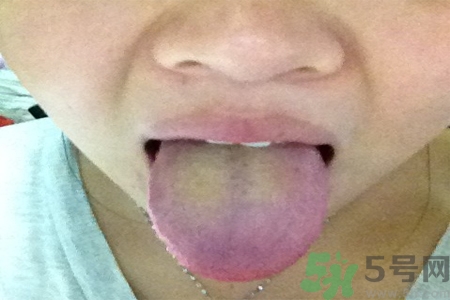 舌苔厚黃是怎么回事？舌頭發(fā)黃怎么辦？