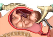 剖腹產(chǎn)橫剖好還是豎剖好？剖腹產(chǎn)橫剖和豎剖有什么區(qū)別？