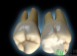 牙齒根管治療多少錢？根管治療一顆要多少錢？