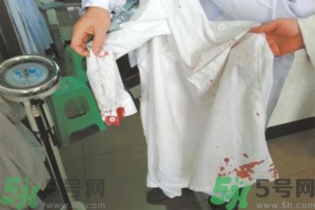 清除衣服上血跡的方法有什么？
