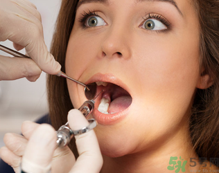 根管治療有什么危害？根管治療的適應(yīng)癥有哪些？