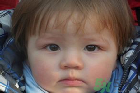 寶寶頭發(fā)黃怎么辦？寶寶頭發(fā)黃什么原因？