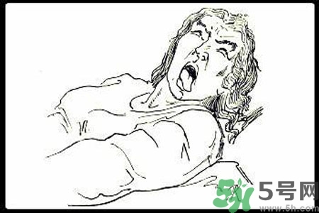 癲癇的護(hù)理措施？癲癇的飲食護(hù)理是什么？