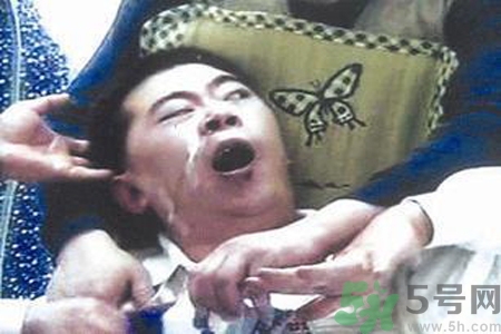 癲癇的發(fā)病因素？癲癇的并發(fā)癥有哪些？