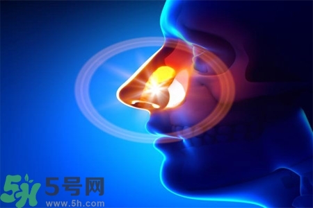 鼻竇炎的高發(fā)人群？如何預(yù)防鼻竇炎？