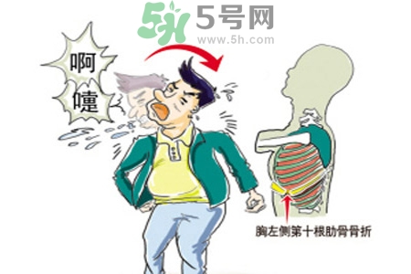 過敏性鼻炎是什么？過敏性鼻炎的癥狀有哪些？