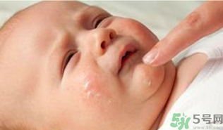 寶寶長奶蘚怎么回事？寶寶長奶蘚怎么辦？