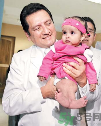 媽媽懷上人魚寶寶 什么是美人魚綜合癥？