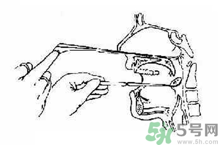 鼻咽癌的日常措施是什么？鼻咽癌注意的飲食有哪些？