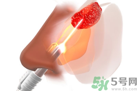 鼻咽癌的日常措施是什么？鼻咽癌注意的飲食有哪些？