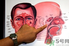 鼻咽癌的發(fā)病因素是什么？鼻咽癌的并發(fā)癥有哪些？