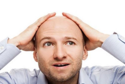 男人禿頂能治好嗎？治療禿頂小偏方