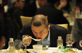 男人禿頂會(huì)遺傳嗎？男人禿頂是腎虛嗎？