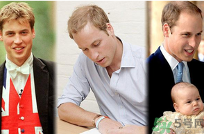 男人禿頂會(huì)遺傳嗎？男人禿頂是腎虛嗎？