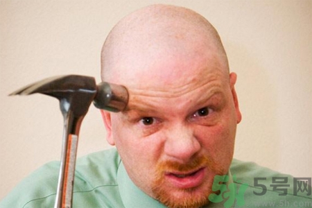 脫發(fā)的高發(fā)人群有哪些？如何預防脫發(fā)？