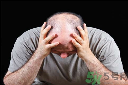 脫發(fā)的高發(fā)人群有哪些？如何預防脫發(fā)？