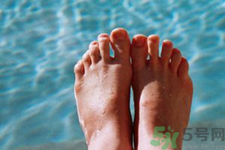 手足癬的治療方法？治療手足癬可以用什么藥？