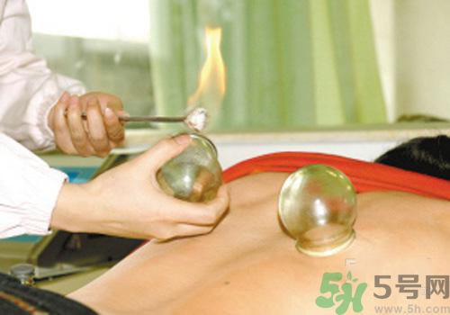 拔火罐和拔氣罐哪個好？拔火罐和拔氣罐的區(qū)別