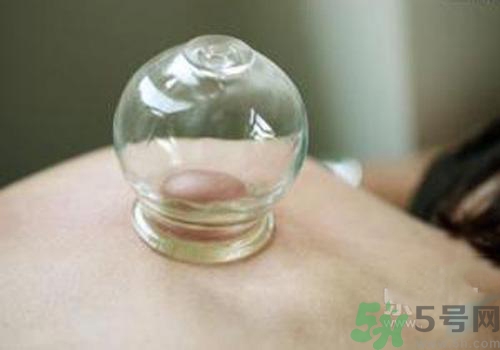 拔火罐和拔氣罐哪個好？拔火罐和拔氣罐的區(qū)別