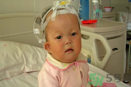 先天性心臟病可以用藥物治療嗎？