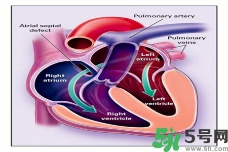 心臟病的癥狀是什么？心臟病的種類有哪些？