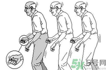 帕金森要注意哪些措施？帕金森的飲食需注意什么？