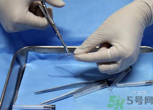 埋線減肥有效嗎？埋線減肥多久有效？