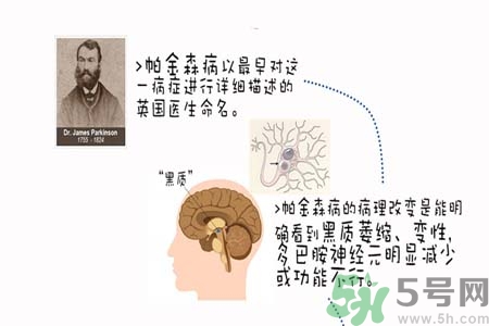 帕金森的治療方法有哪些？