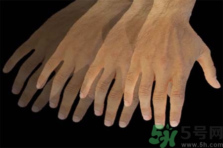 帕金森的易發(fā)人群有哪些？如何預(yù)防帕金森？