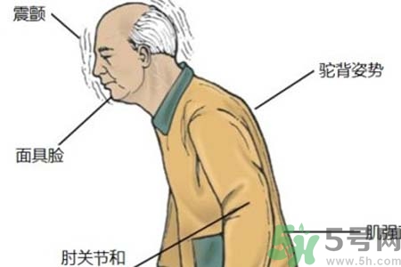 帕金森的易發(fā)人群有哪些？如何預(yù)防帕金森？