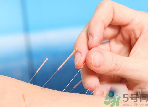 埋線減肥多少錢一次？埋線減肥的副作用