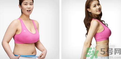 埋線減肥多少錢一次？埋線減肥的副作用