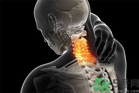 為什么年輕人容易得頸椎??？頸椎病嚴重的癥狀有哪些？