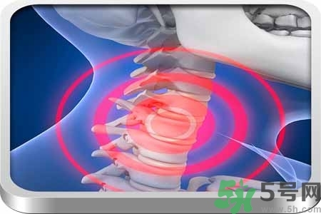 為什么年輕人容易得頸椎??？頸椎病嚴重的癥狀有哪些？